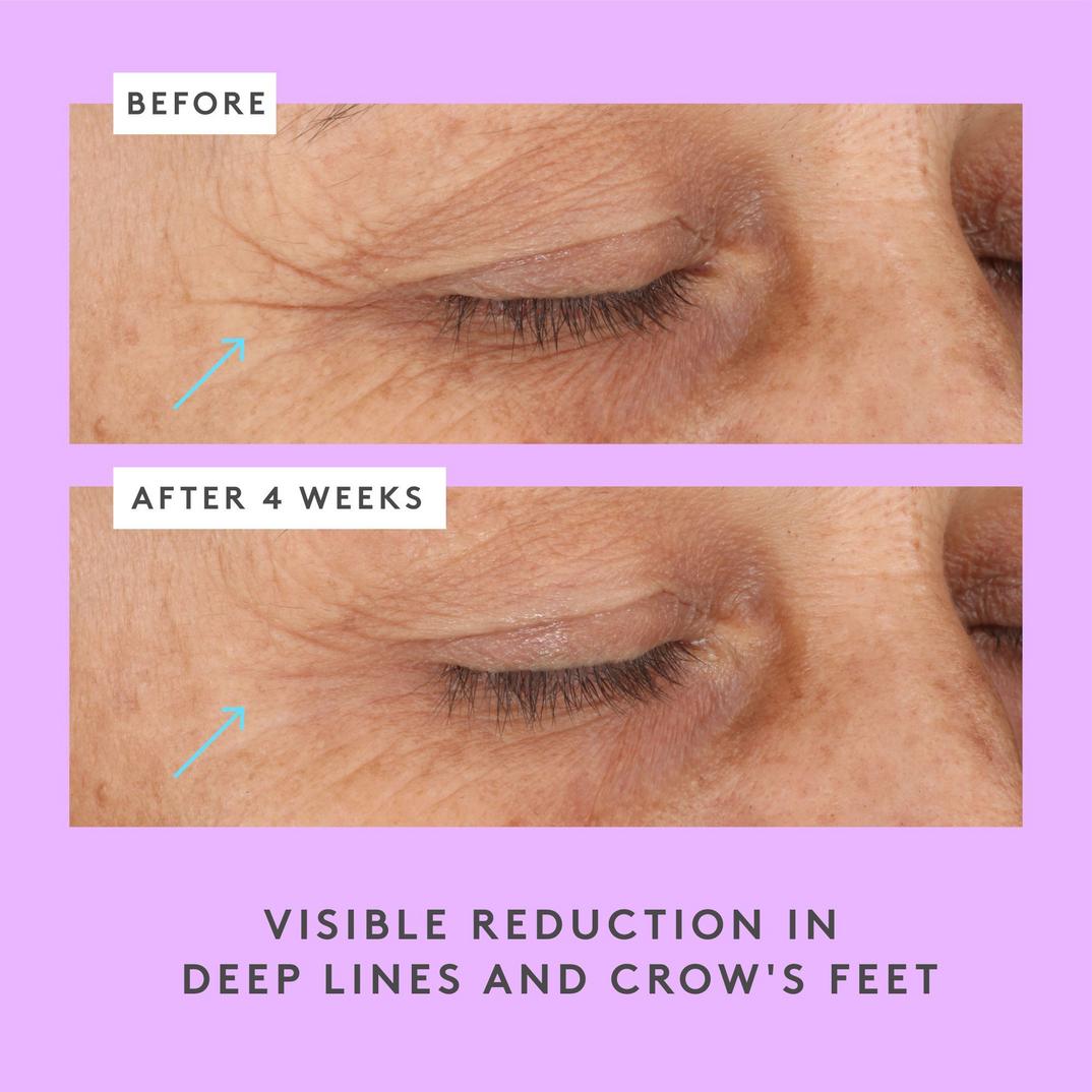 Drunk Elephant Ceramighty AF Eye Balm