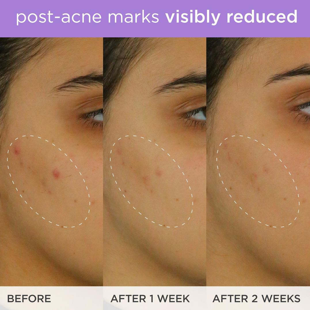 TATCHA The Brightening Serum