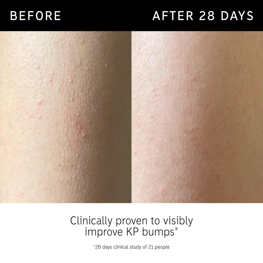 INKEY Glycolic Acid Exfoliating Body Stick
