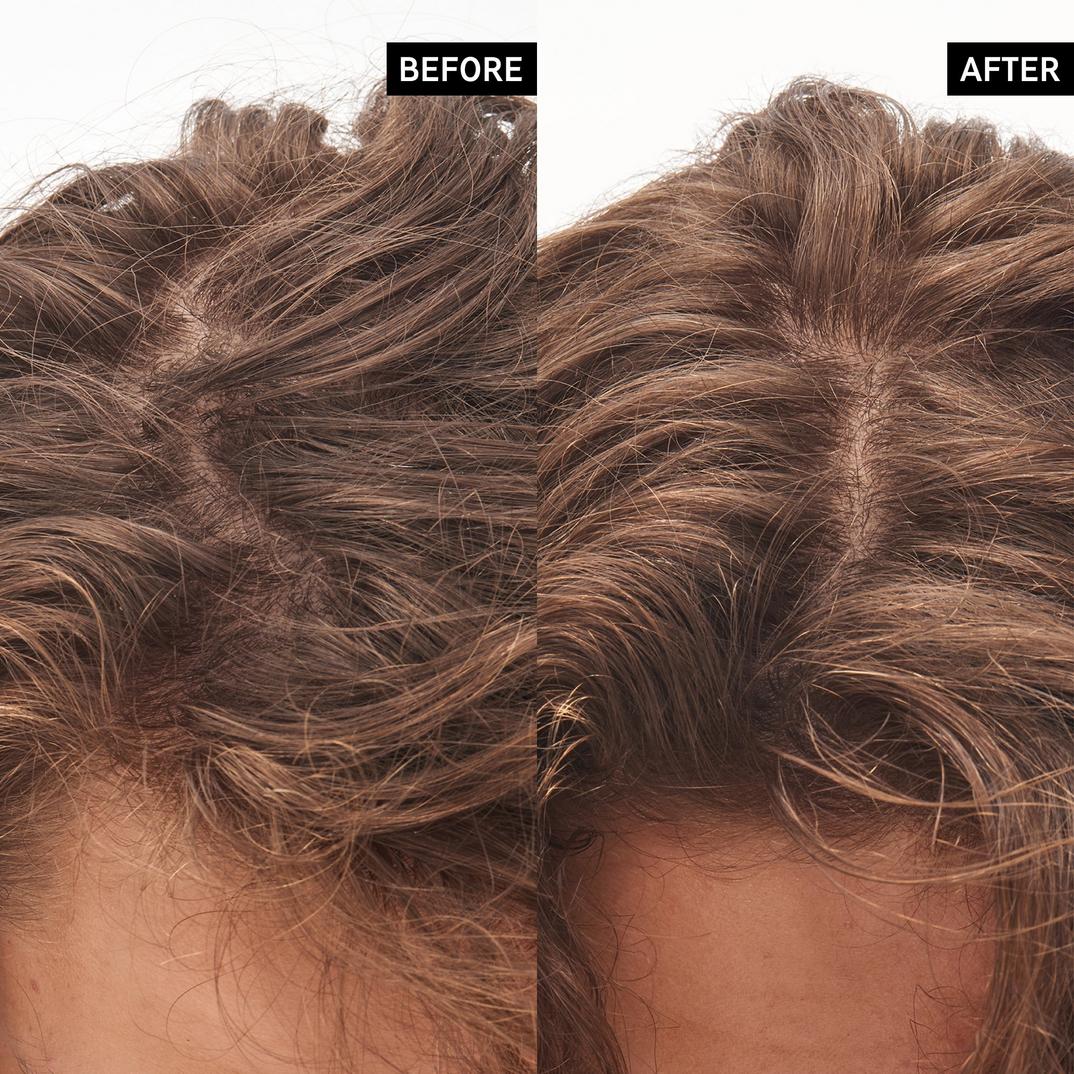INKEY Glycolic Acid Exfoliating Scalp Scrub