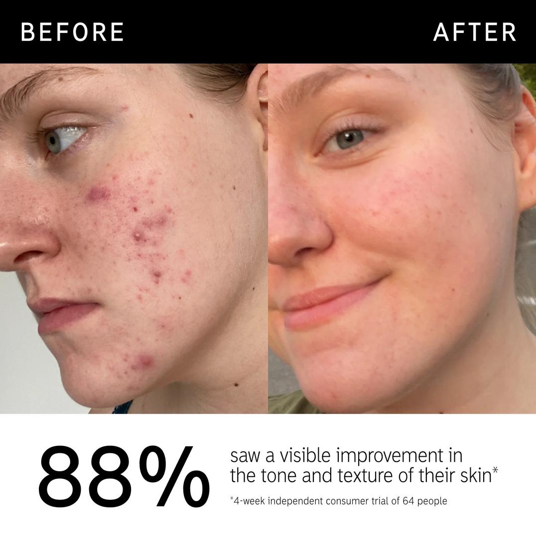 INKEY 15% Vitamin C & EGF Brightening Serum