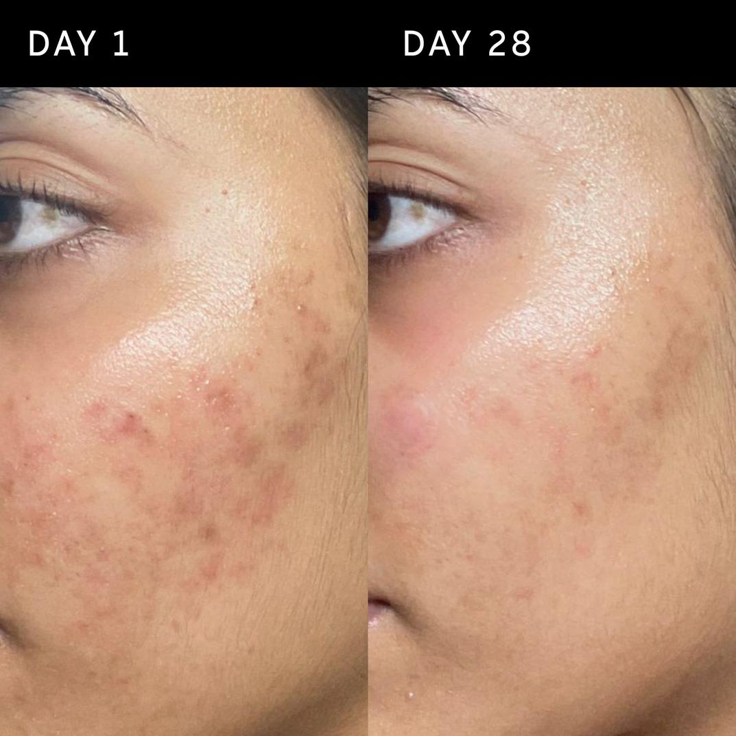INKEY Ectoin Hydro-Barrier Serum