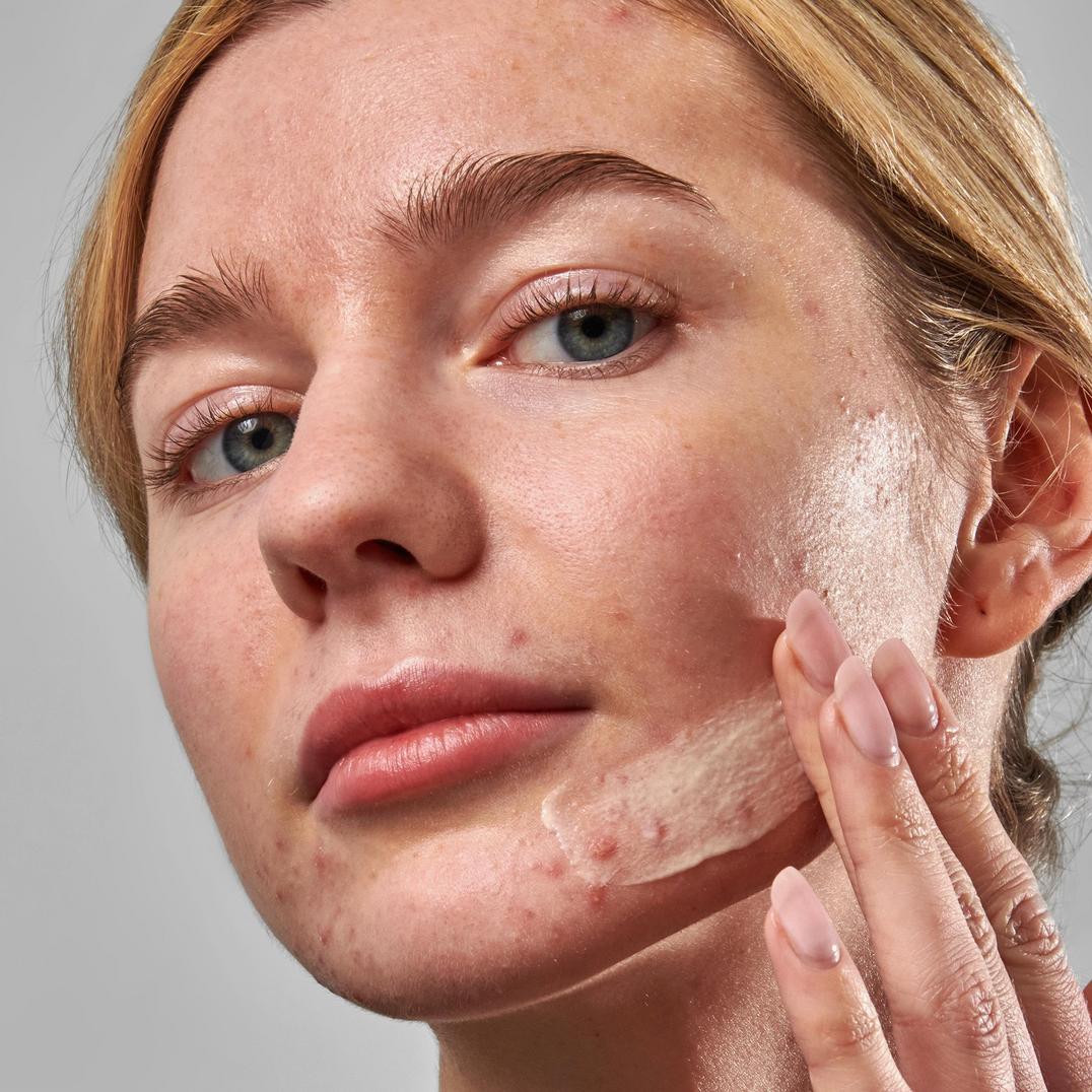 INKEY SuperSolutions Blemish Clearing Moisturizer 2% Novoretin