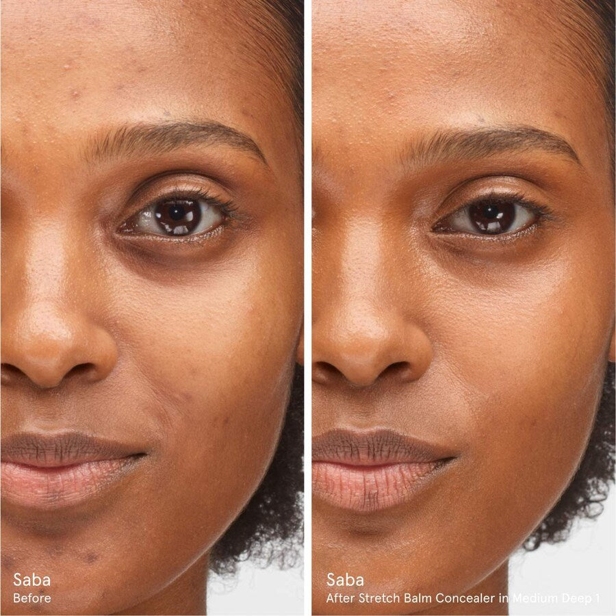 #color_medium-deep-1