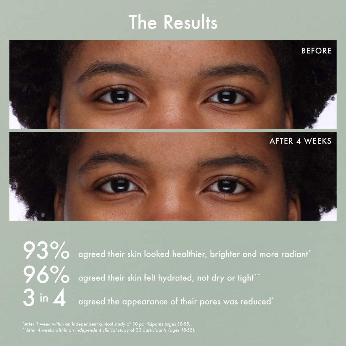 Gentle Reset Daily Exfoliating Pads to Smooth + Minimize Pores with AHAs