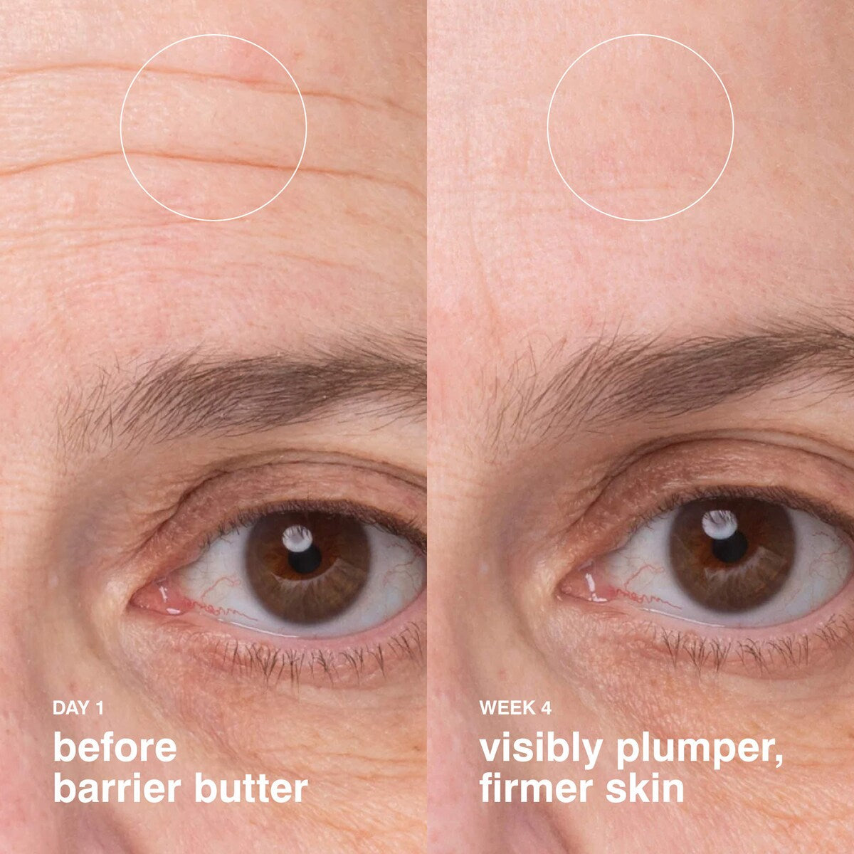 Barrier Butter Intensive Moisture Balm